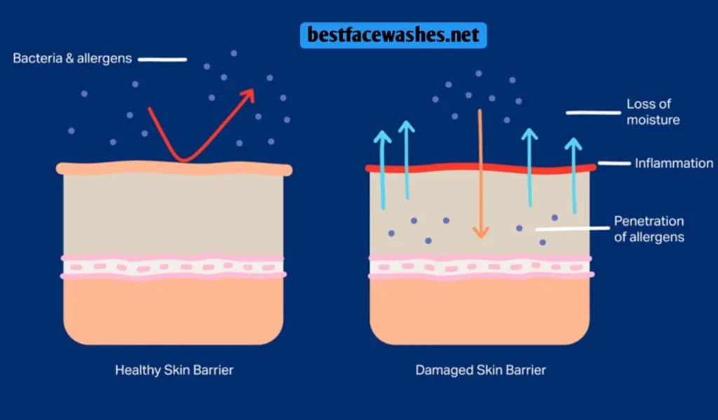 What Is the Skin Barrier