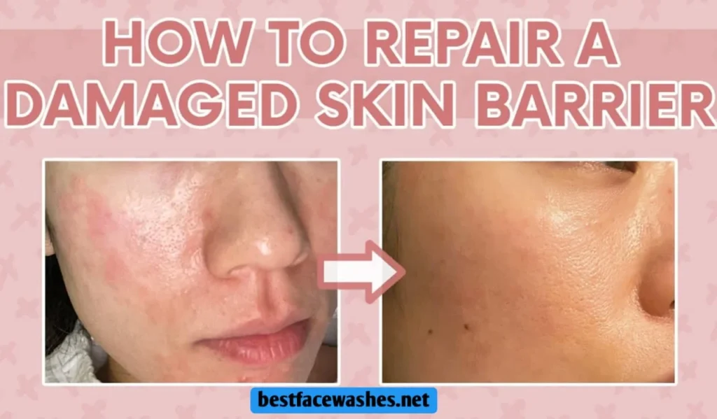 Restoring a Damaged Skin Barrier