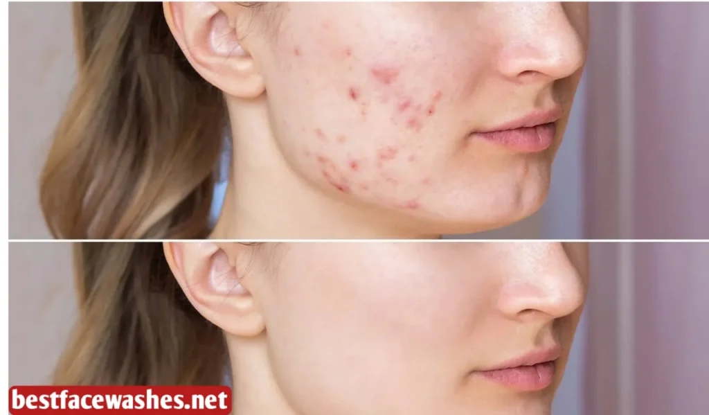 How Long It Takes to See Results