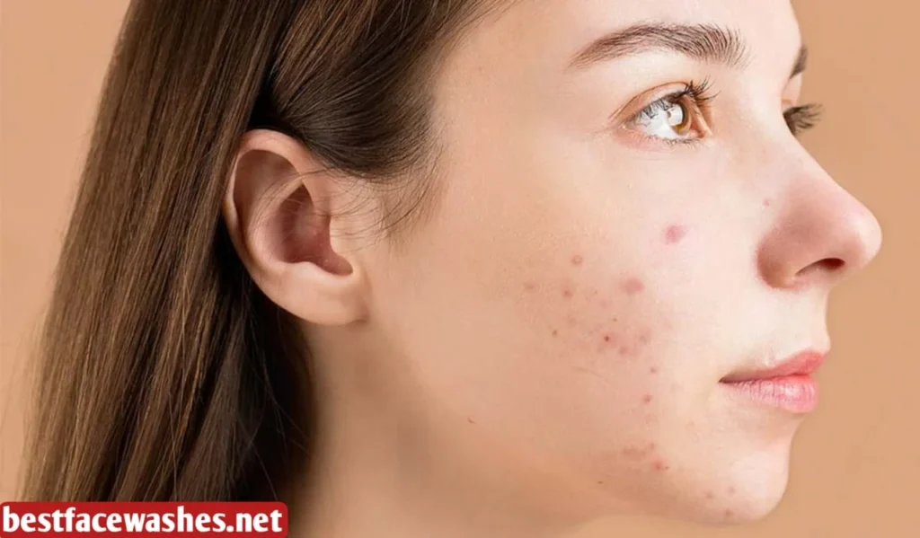 Why Sudden Face Wash Changes