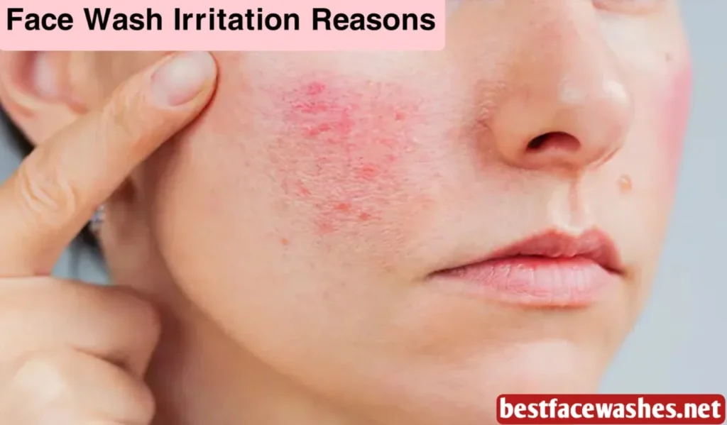Face Wash Irritation Reasons
