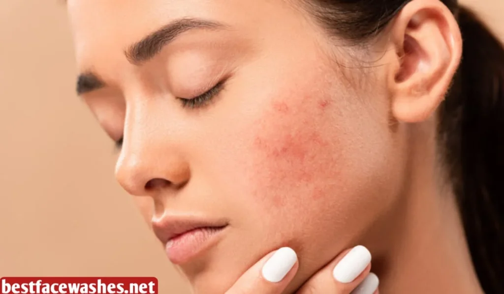 Suitable for Sensitive and Acne-Prone Skin