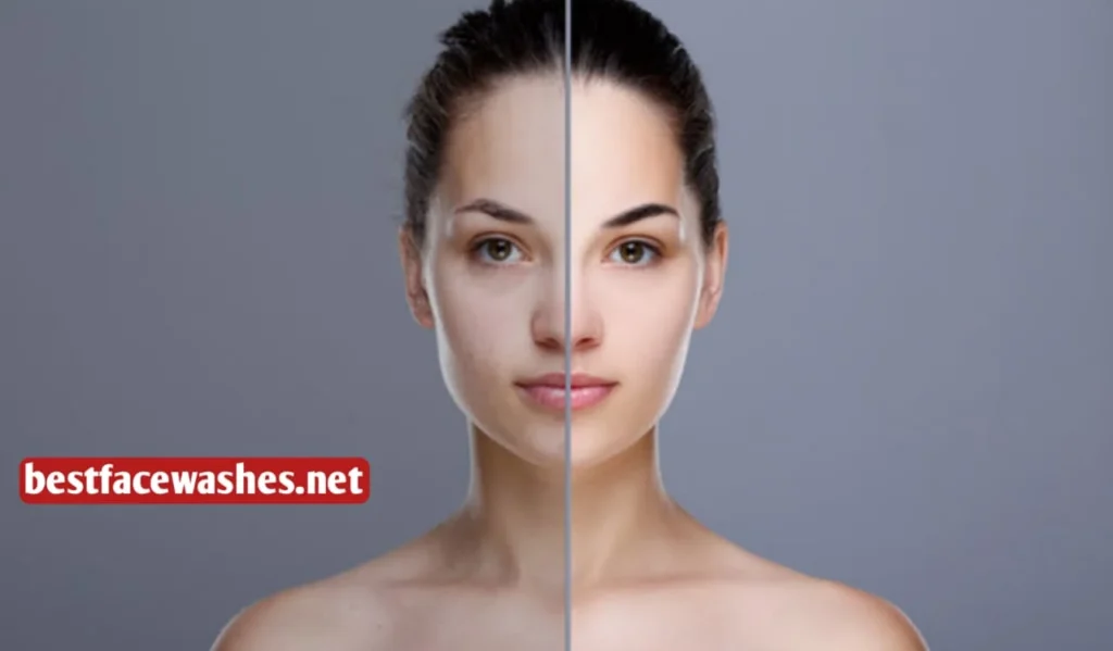 Brightens Skin and Evens Out Tone