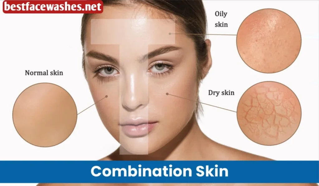 Balances Dry and Combination Skin