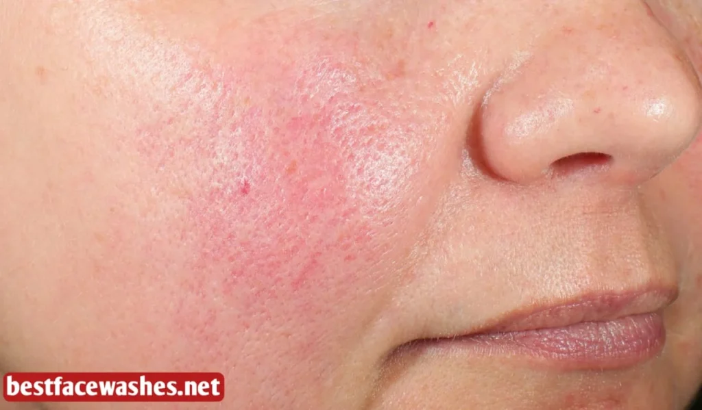 What Causes Skin Barrier Damage