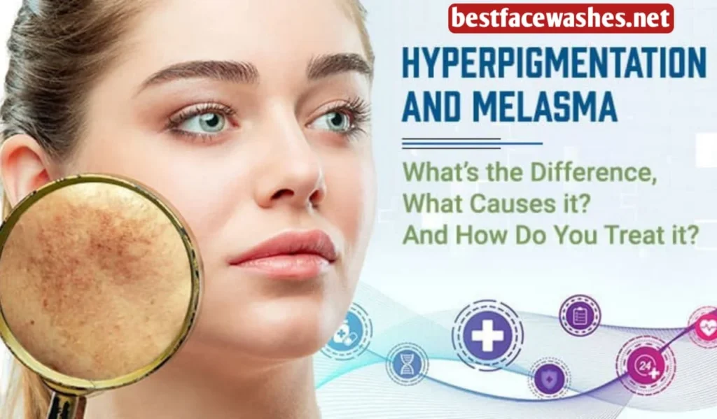What Causes Hyperpigmentation