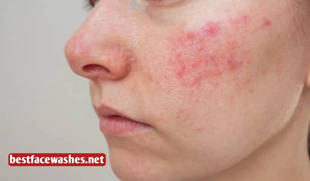 Common Causes of Skin Irritation