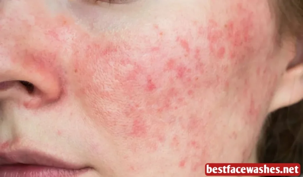 Common Causes of Skin Irritation