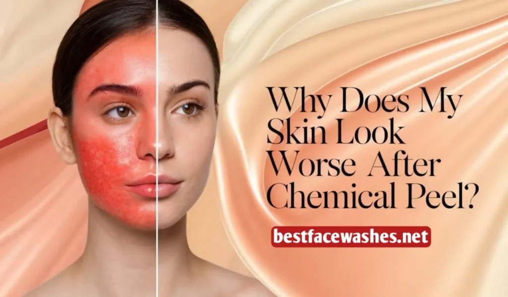 Why Skin Is Sensitive After a Peel