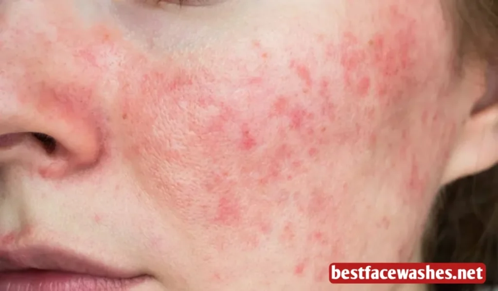 Common Triggers for Skin Allergies