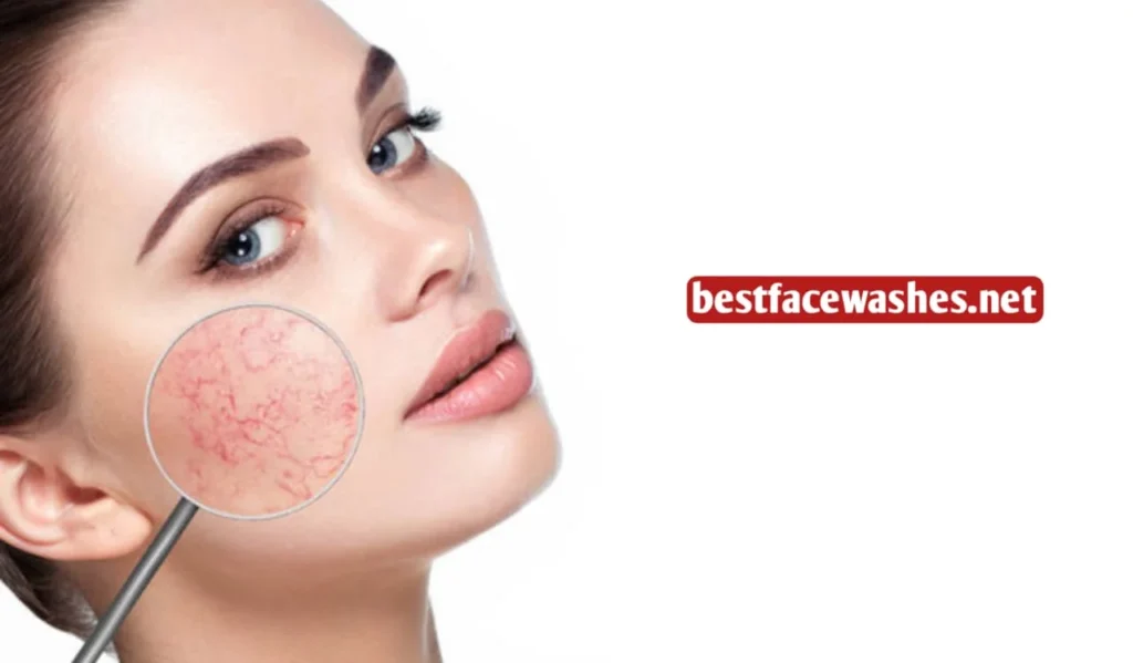 Why Dry Skin Needs Gentle Formulas