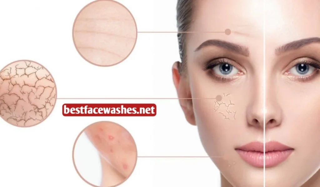 Understanding Skin Types and Needs