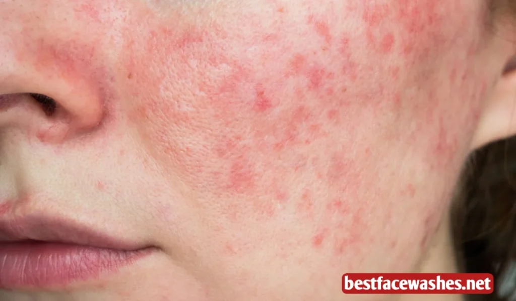 Understanding the Skin Barrier